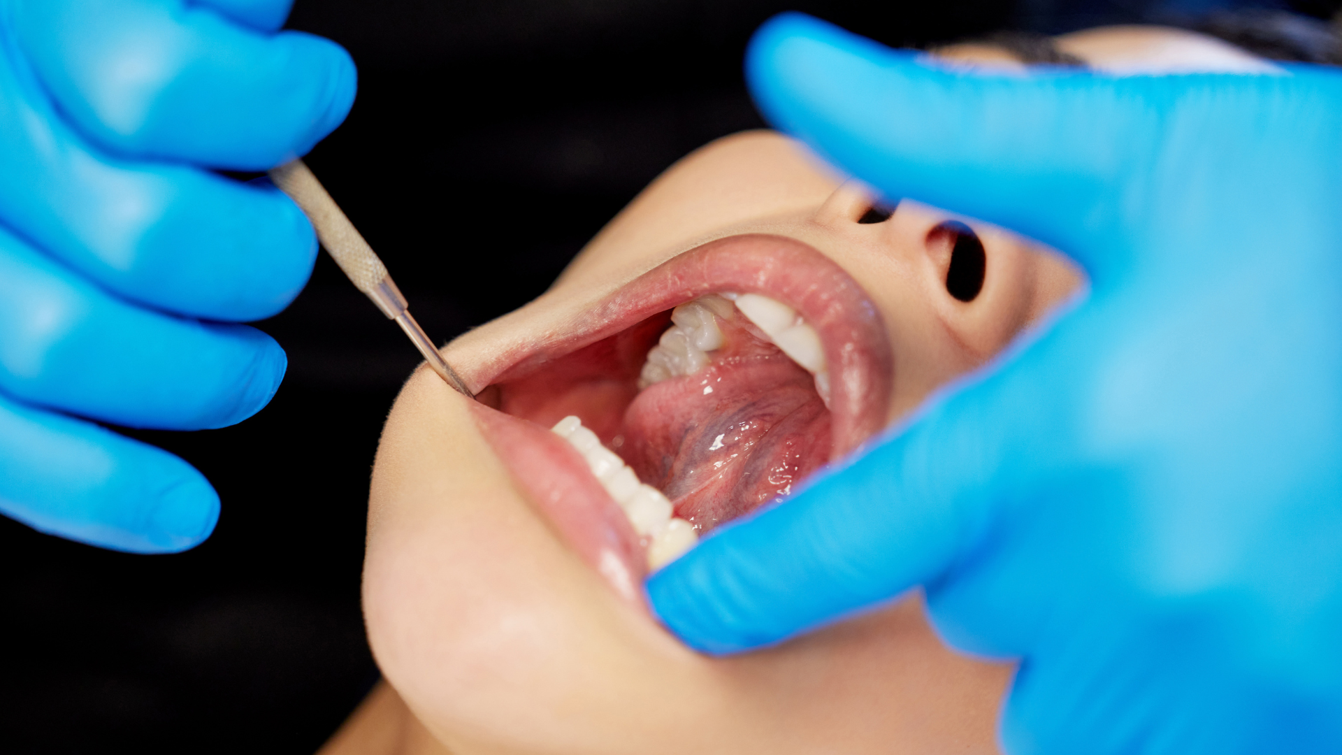 Can Red Light Therapy Help with Enamel Erosion?